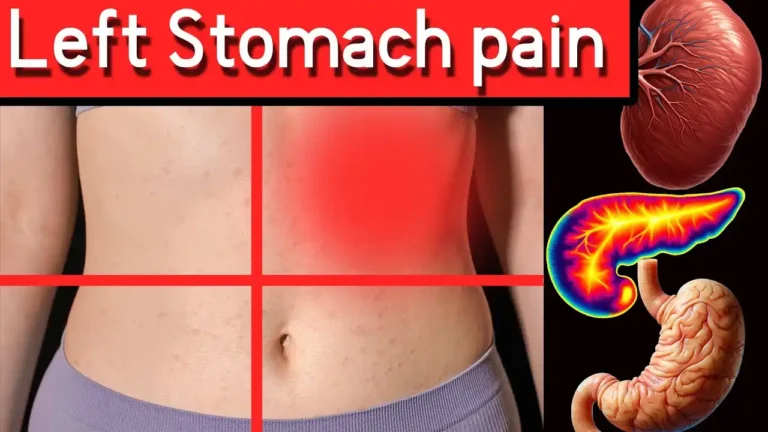 Left Side Stomach Pain